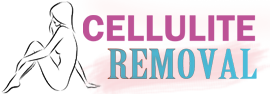 celluliteremoval Logo